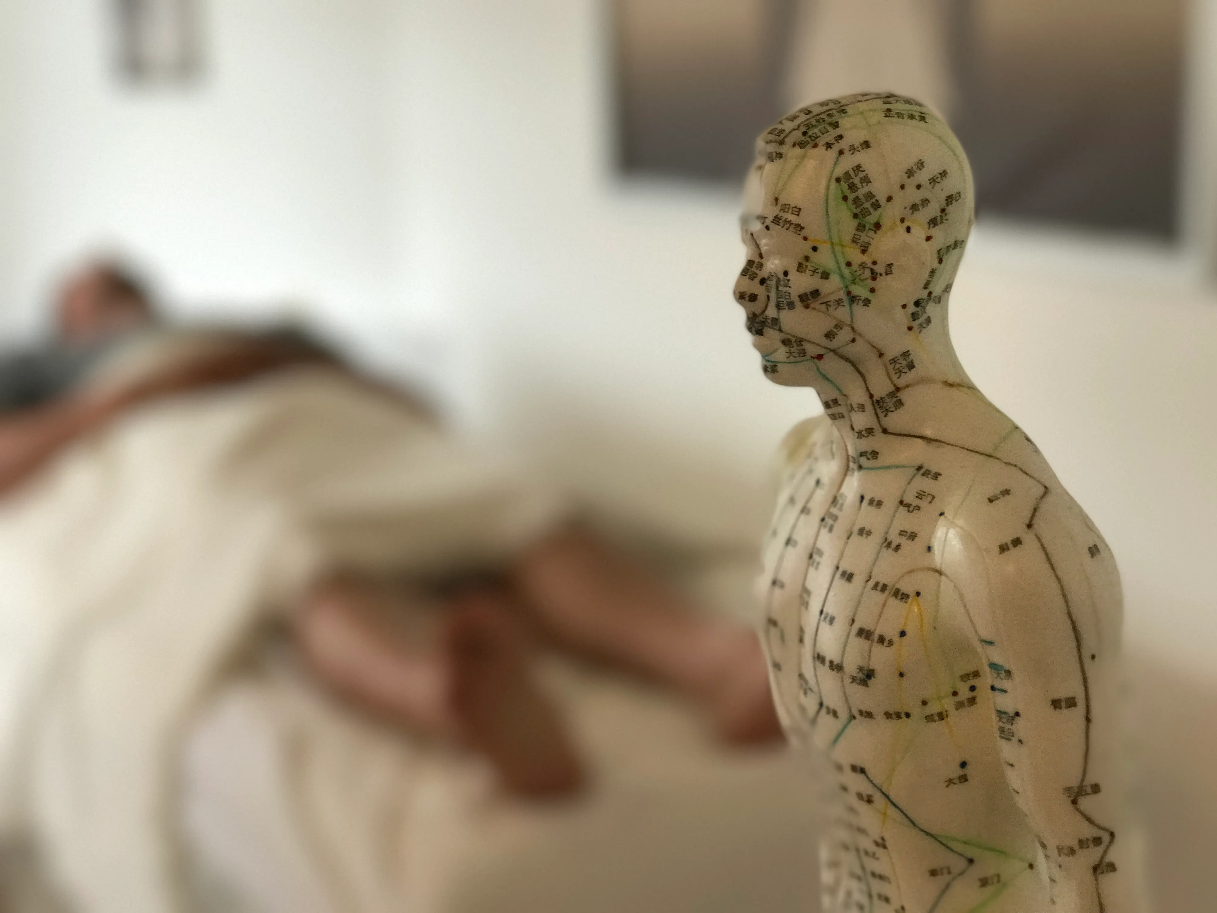 Akupunkturmodel i forgrunden og en patient på briksen i baggrunden